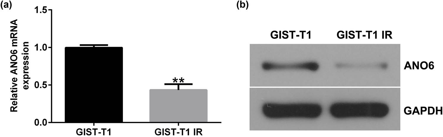 Figure 2
Expression of ANO6 (TMEM16F) in GIST-T1 and GIST-T1 IR cells. The relative levels of ANO6 (TMEM16F) in GIST-T1 and GIST-T1 IR cells were evaluated by (a) RT-qPCR and (b) western blotting, respectively. **P < 0.01.