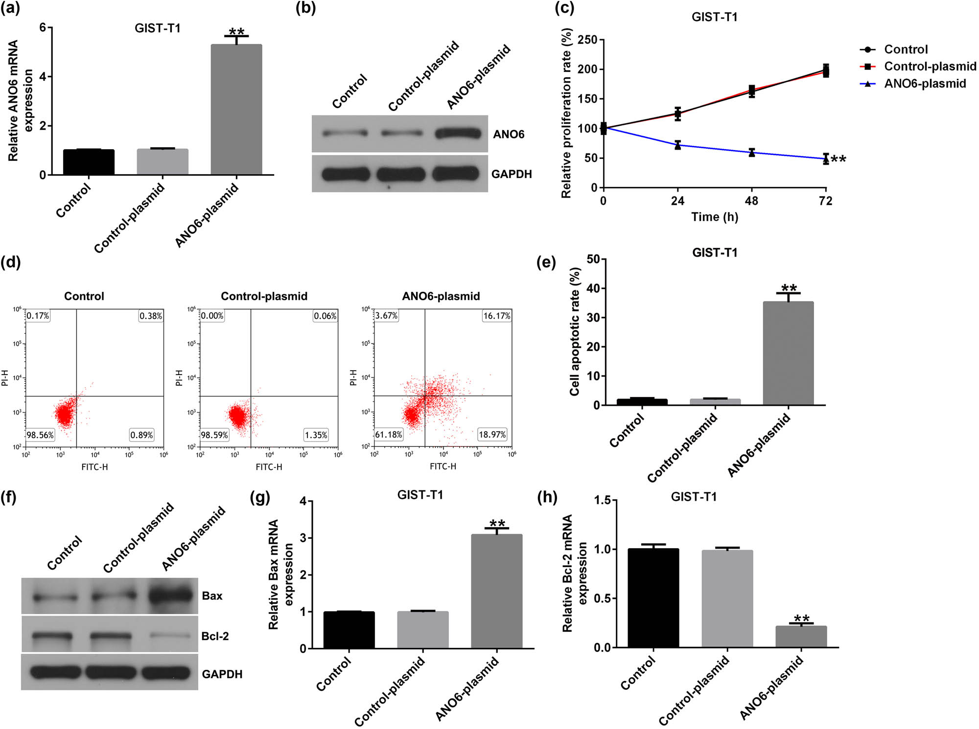 Figure 3
Effects of ANO6 (TMEM16F) on GIST-T1 cell proliferation and apoptosis. GIST-T1 cells were transfected with the control-plasmid and the ANO6-plasmid. (a) and (b) RT-qPCR and western blot analysis of ANO6 (TMEM16F) levels in the control-plasmid and ANO6-plasmid groups. (c) The growth of GIST-T1 cells was assessed by MTT. (d) Apoptosis was determined by flow cytometry. (e) Quantification of apoptotic GIST-T1 cells. (f) Western blotting analysis of Bax and Bcl-2 expression. (g) and (h) Bax and Bcl-2 mRNA levels were determined using RT-qPCR. **P < 0.01.