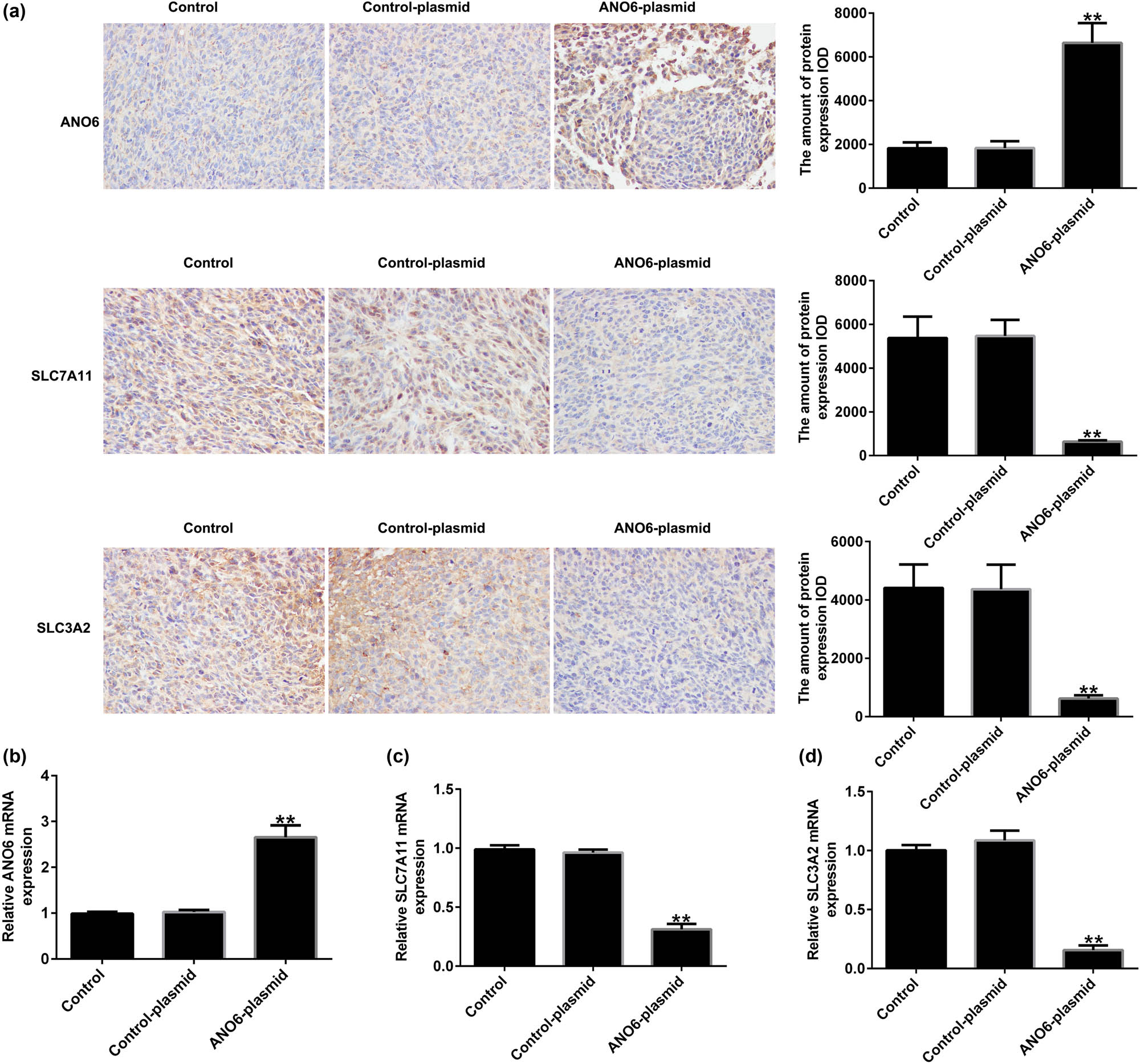 Figure 9
Effects of ANO6 (TMEM16F) on SLC7A11 and SLC3A2 expression in GIST in vivo. (a) The expression of ANO6 (TMEM16F), SLC7A11, and SLC3A2 in GIST tissues was determined using IHC assays. (b)–(d) mRNA expression of ANO6 (TMEM16F), SLC7A11, and SLC3A2 in GISTs tissues was determined by RT-qPCR. **P < 0.01 vs control-plasmid.