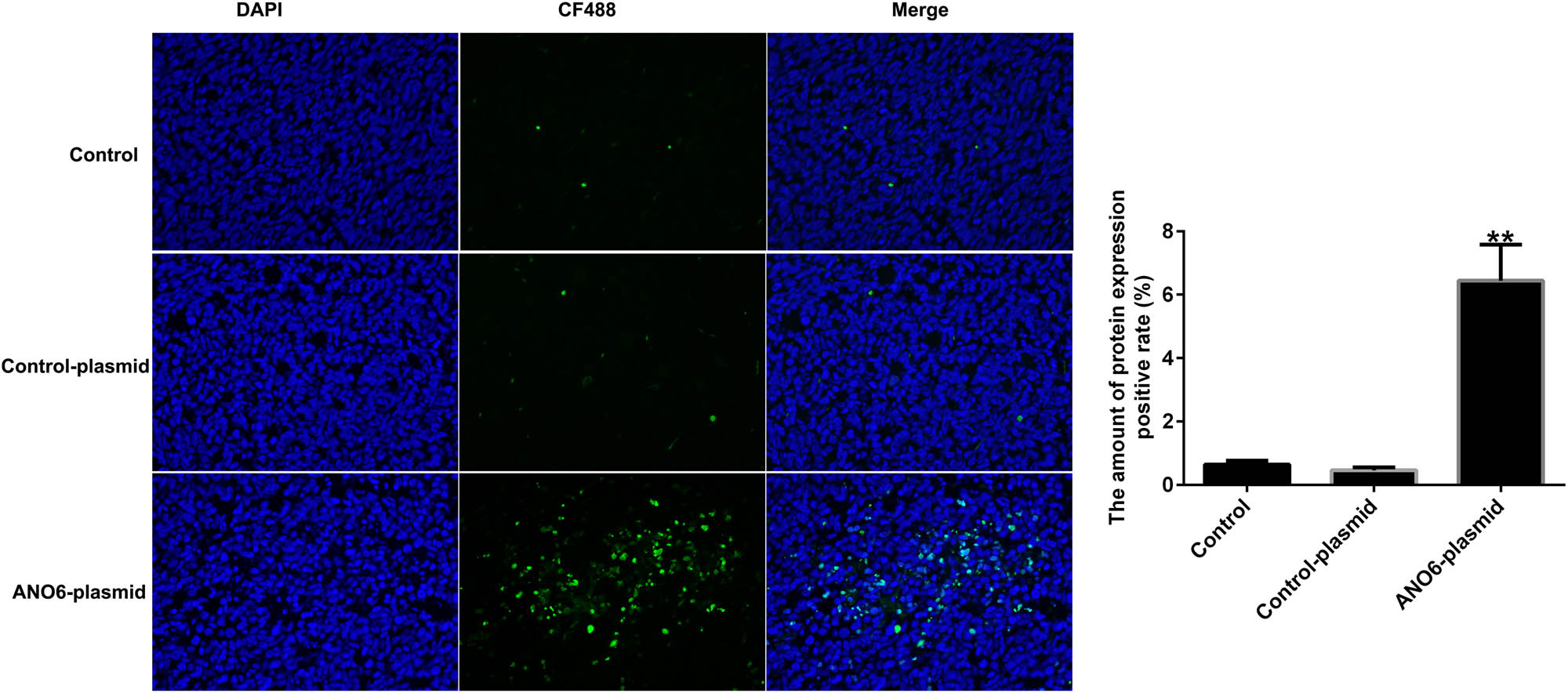 Figure 10
Effects of ANO6 (TMEM16F) on GIST cell apoptosis in vivo. TUNEL images of tumor samples and quantitative analysis of apoptosis rates. **P < 0.01 vs control-plasmid.