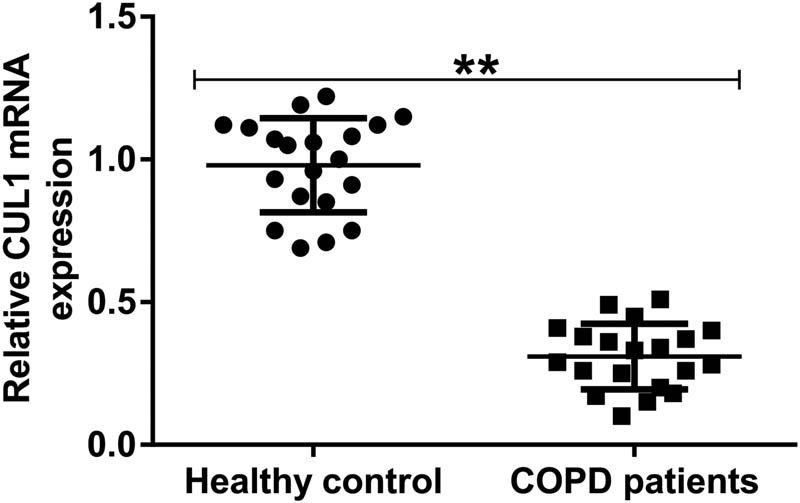 Figure 1
The expression level of CUL1 in the serum of patients with COPD. The expression of CUL1 was detected using qRT-PCR. **P < 0.01. COPD, chronic obstructive pulmonary disease; CUL1, cullin-1; qRT-PCR, quantitative real-time reverse-transcription PCR.
