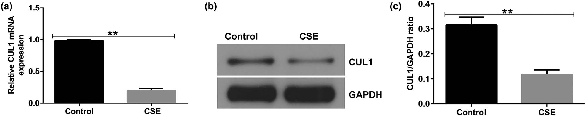 Figure 2
The expression level of CUL1 in a CSE-induced cell model. (a) mRNA expression level of CUL1 detected by qRT-PCR. (b) Protein expression level of CUL1 detected by Western blot assay. (c) CUL1/GAPDH ratio. **P < 0.01. CSE, cigarette smoke extract; CUL1, cullin-1; GAPDH, glyceraldehyde 3-phosphate dehydrogenase; qRT-PCR, quantitative real-time reverse-transcription PCR.