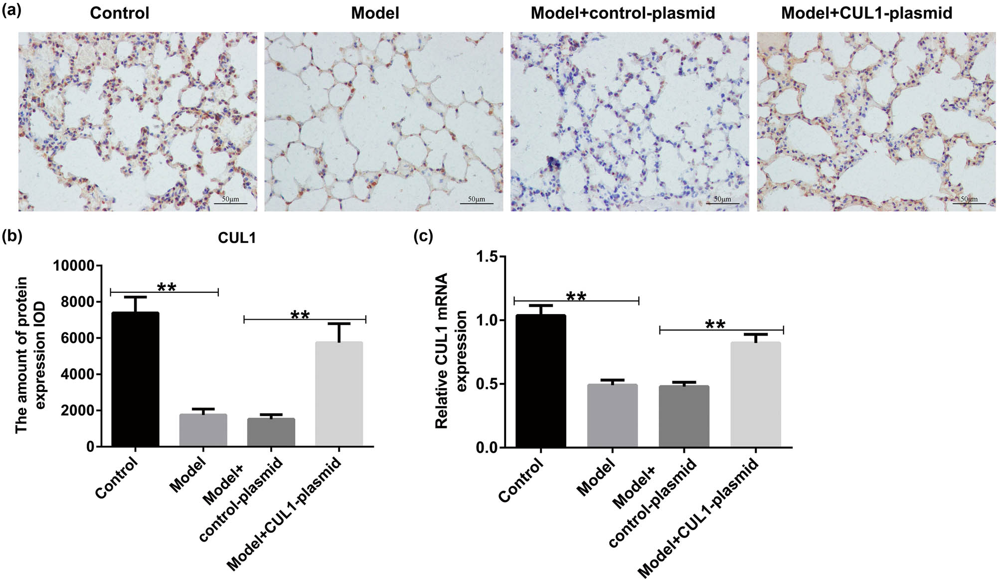 Figure 8
The expression level of CUL1 in lung tissues of mice with COPD. (a and b) IHC staining was conducted to evaluate the distribution of CUL1. (c) mRNA expression level of CUL1 detected by qRT-PCR. **P < 0.01. COPD, chronic obstructive pulmonary disease; CUL1, cullin-1; IHC, immunohistochemistry; qRT-PCR, quantitative real-time reverse-transcription PCR.