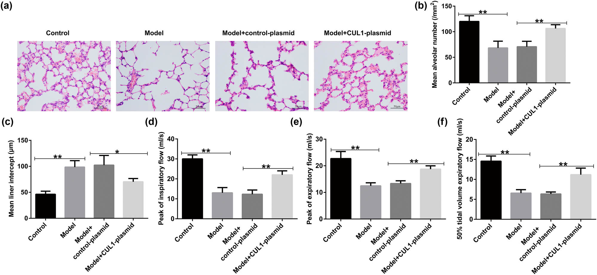 Figure 9
The effects of the CUL1-plasmid on lung function. (a) Pathological changes in the lung tissues of mice detected by H&E staining. (b and c) Changes in MAN and MLI in different groups. (d–f) Calculation of PIF, PEF, and EF50 to evaluate the pulmonary function. *P < 0.05, **P < 0.01. CUL1, cullin-1; EF50, expiratory flow at 50% ventilation; H&E, hematoxylin and eosin; MAN, mean alveolar number; MLI, mean linear intercept; PEF, peak expiratory flow; PIF, peak inspiratory flow.