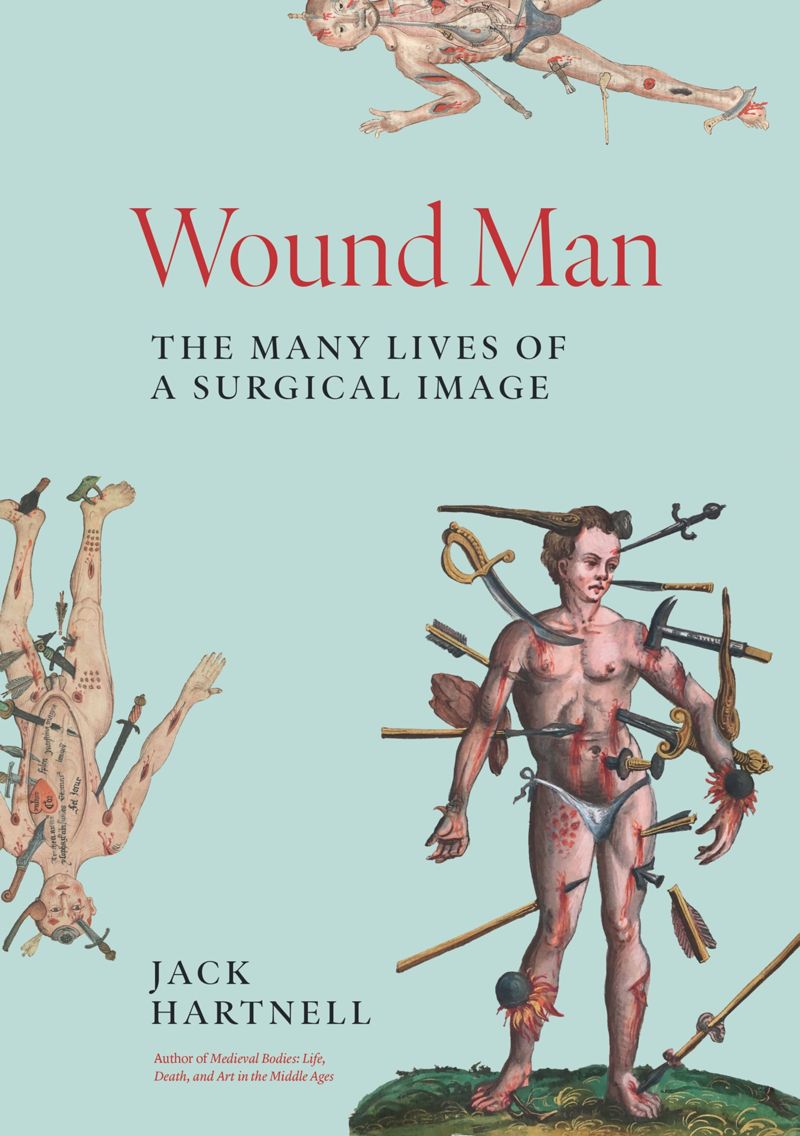 book: Wound Man