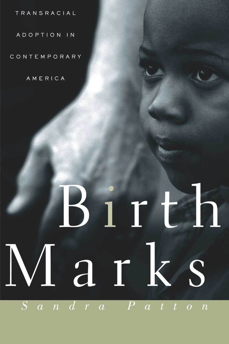 book: Birthmarks