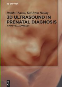 book: 3D Ultrasound in Prenatal Diagnosis