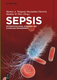 book: Sepsis