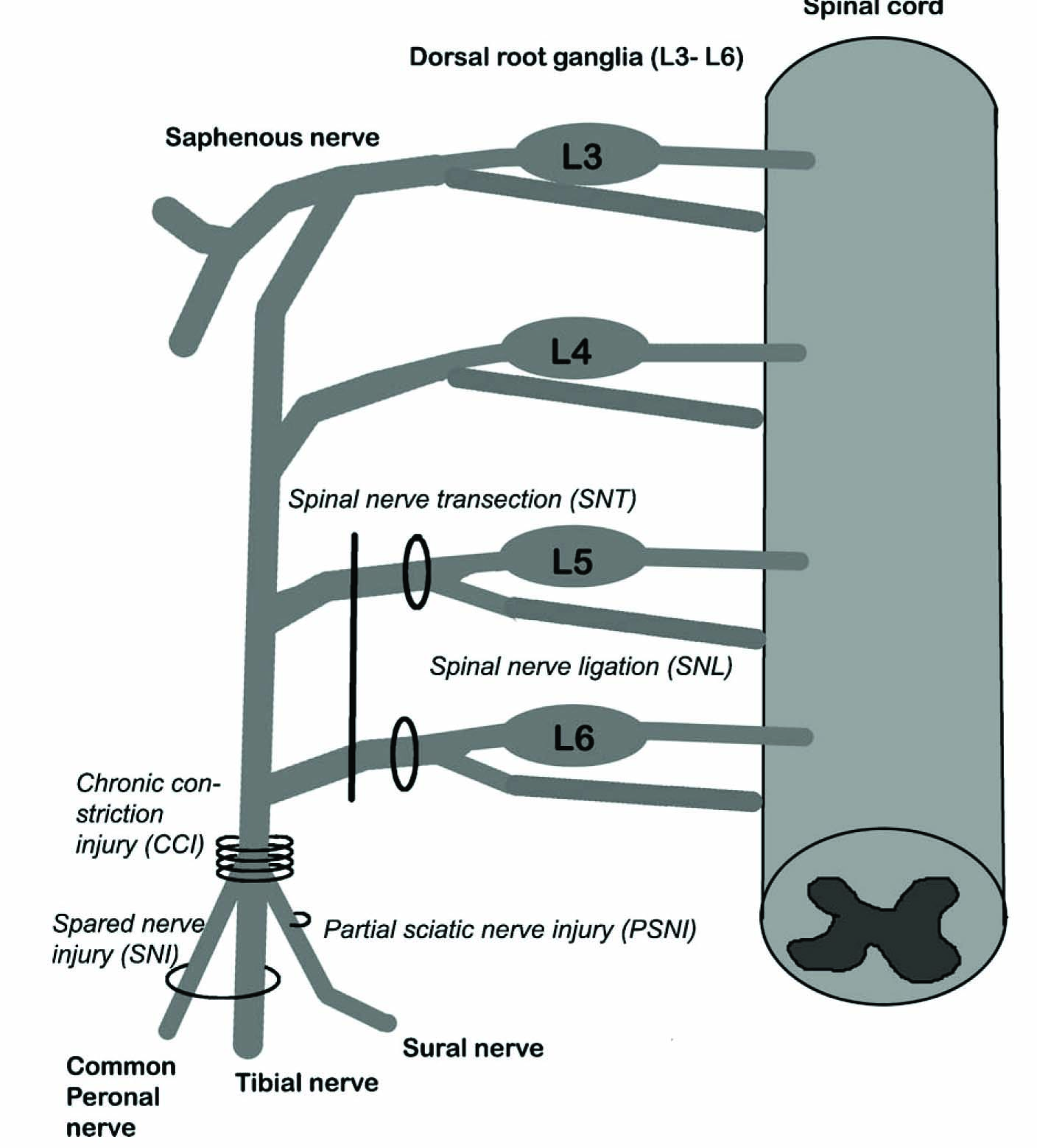 Fig. 1 
            Injury positions for generation of animal models of neuropathic pain. (A) Spared nerve injury, SNI [16], (B) spinal nerve ligation, SNL [20], (C) spinal nerve transection, SNT [28], (D) chronic constriction injury, CCI [10] and (E) partial sciatic nerve injury, PSNI [31].
          