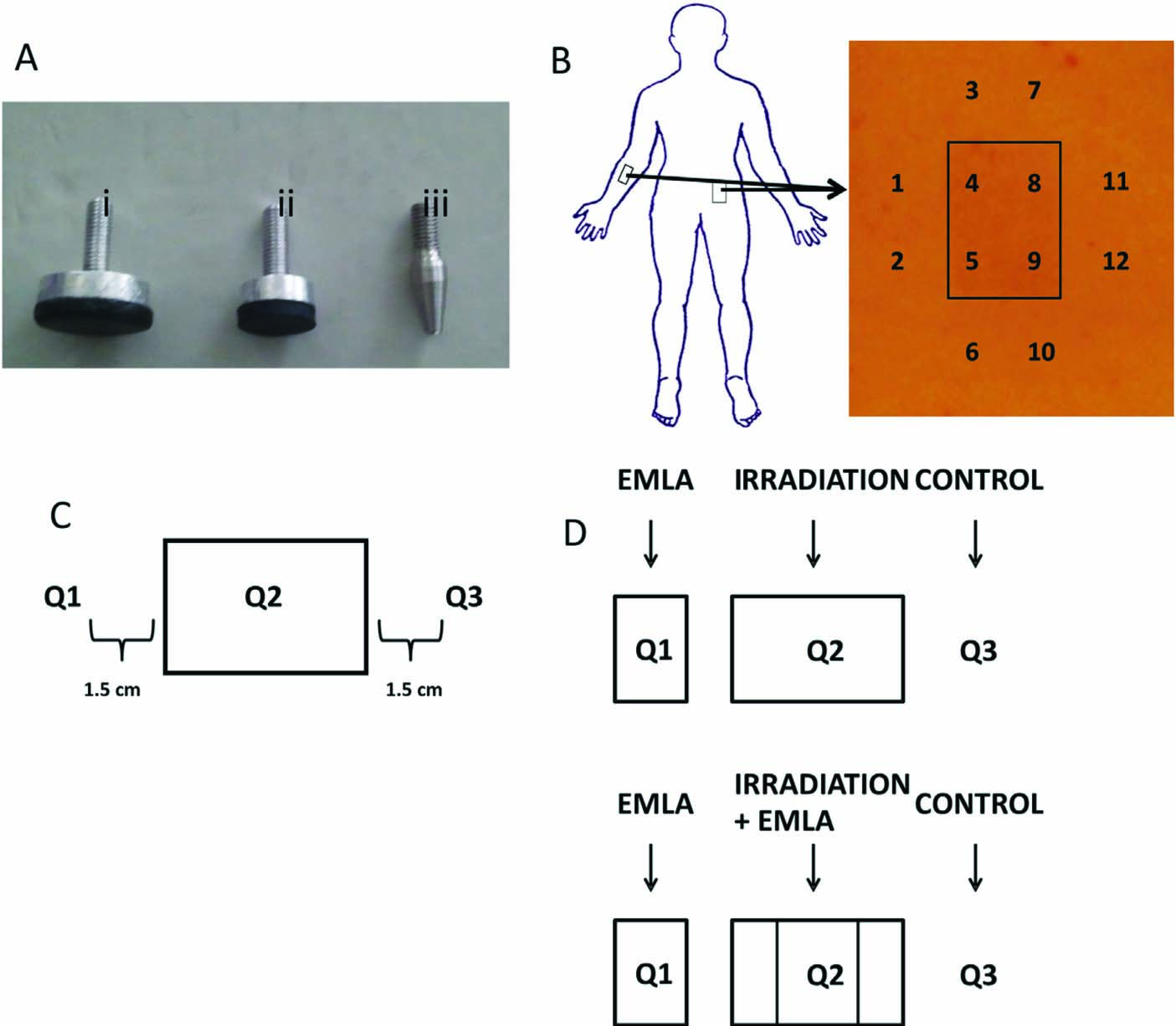 Fig. 1 
              Experimental overview: (A) The three different probes used for pressure algometry: 1.0cm2 flat probe (i), 0.5 cm2 flat probe (ii), and V-shaped probe with a flat contact surface of 0.03 cm2 (iii). (B) Assessment sites, experiment 1: four assessment sites located inside the UVB irradiation area and eight outer assessment sites on the left forearm and low back. The 8 outer sites were 1.5cm distant from the irradiated area. The four sites inside the irradiation area were approximately 0.5cm from the boarder of irradiation. The sites 3 and 7 were located most distally or rostrally for the arm and low back, respectively. (C) Assessment sites, experiment 2: one assessment site located inside the UVB irradiation area (Q2) and two outer assessment sites on both left and right forearm (Q1 and Q3). The two outer sites were 1.5cm distant from the irradiated area. (D) Schematic representation of the two EMLA applications on the forearm.