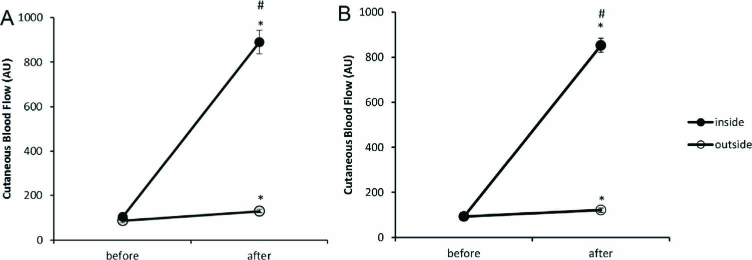 Fig. 2 
              Cutaneous blood flow: Mean (±SEM, N = 16) skin blood flow in arbitrary units (AU) before and 24h after UVB irradiation inside and outside the area irradiated on the arm (A) and on the back (B). A significantly increased blood flow was observed compared with baseline values (#, BON: P<0.01) and the inside compared with the outside area (#, BON: P<0.01).