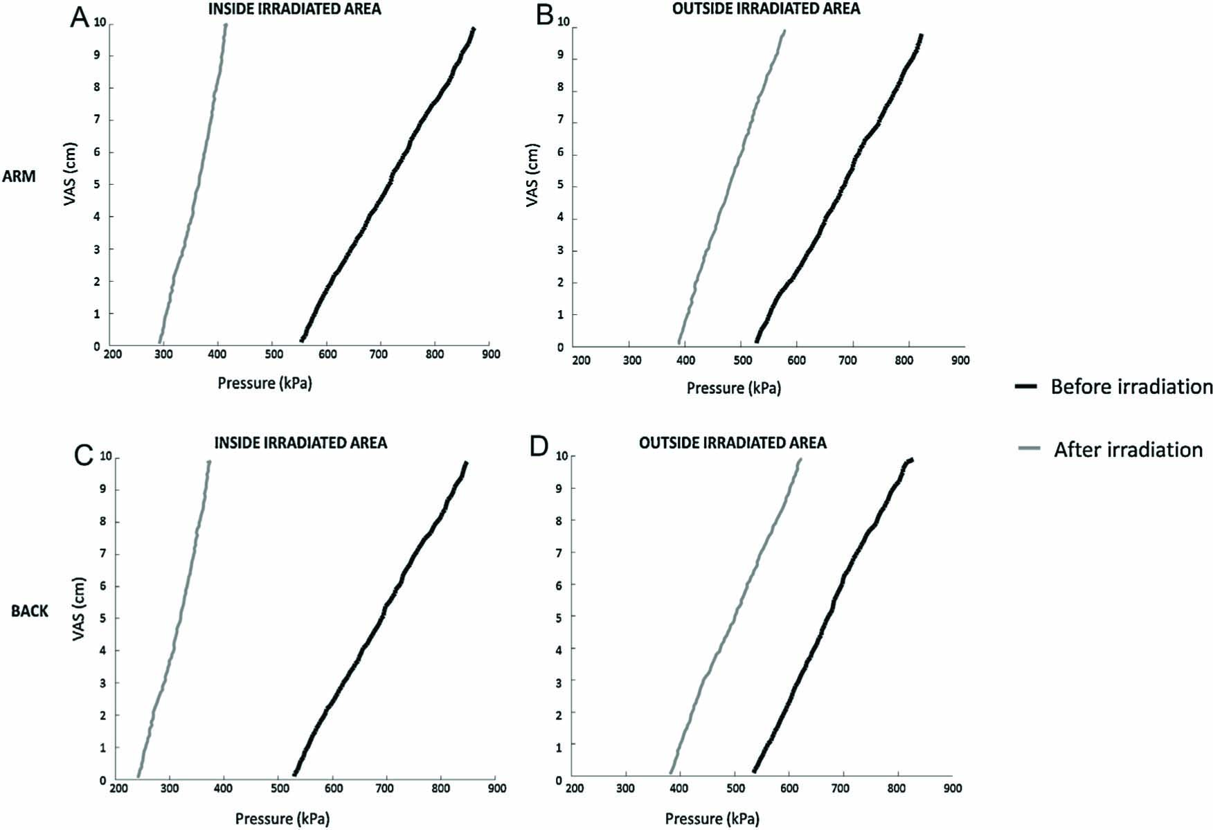 Fig. 6 
              Pressure intensity versus VAS scores: inside (A) and outside (B) the irradiated area on the low back and arm. The curves are based on the average of 16 subjects from assessments with the 0.5 cm2 probe. In normal skin (black curve, before irradiation), VAS score increases moderately fast with increasing pressure stimulus intensity. After irradiation (grey curve), the stimulus–response curve is shifted to the left; there is a lower threshold for producing pain and an increased response to suprathreshold stimuli.