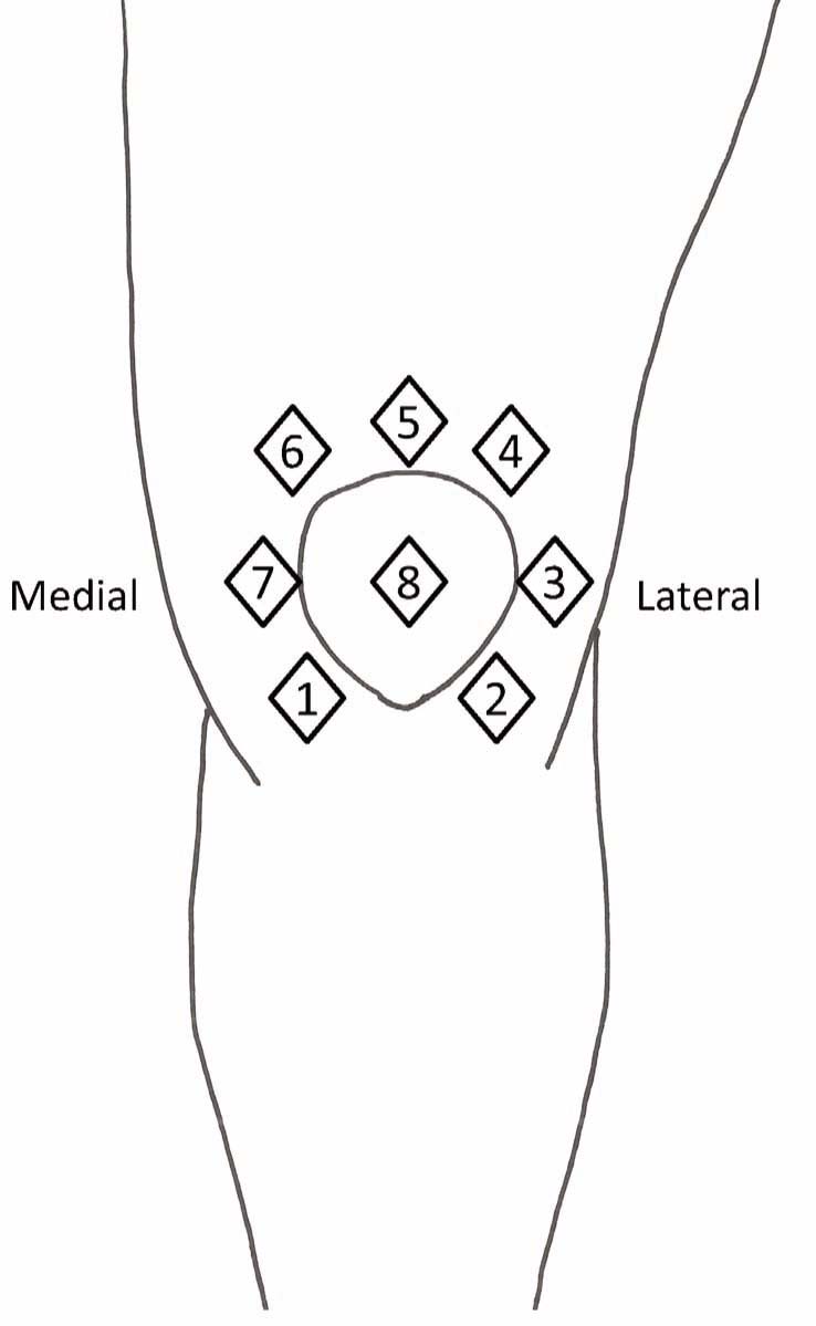 Fig. 1
The eight assessment sites around the injected knee.