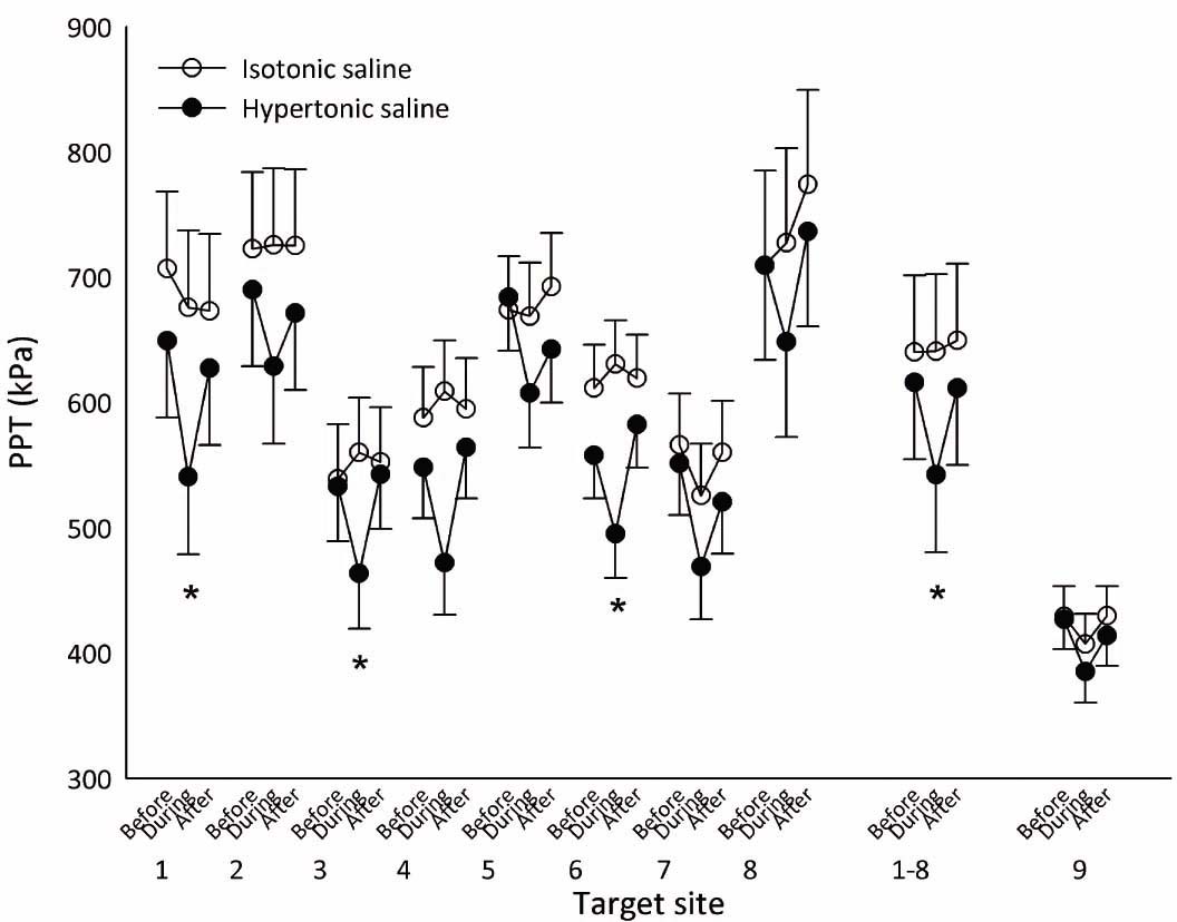 Fig. 4
Mean PPTs (±SEM; N = 10, during pain after hypertonic saline N = 9) from assessment sites 1–8 (see Fig. 1), assessment sites 1–8 pooled, and the contralateral control site 9 before, during and after injection of hypertonic (filled circles) and isotonic saline (open circles). A general tendency towards reduced PPT at all sites was observed during the experimental pain (hypertonic saline injection), which was confirmed in the analysis of the pooled PPTs. *PPT significantly reduced during hypertonic saline compared with isotonic saline (P×0.001).