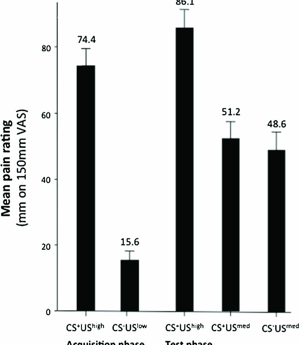Fig. 3 
              Mean pain intensity ratings for each stimulus type. Intensity ratings measured in millimetres on a 150 mm VAS. Error bars denote SE.