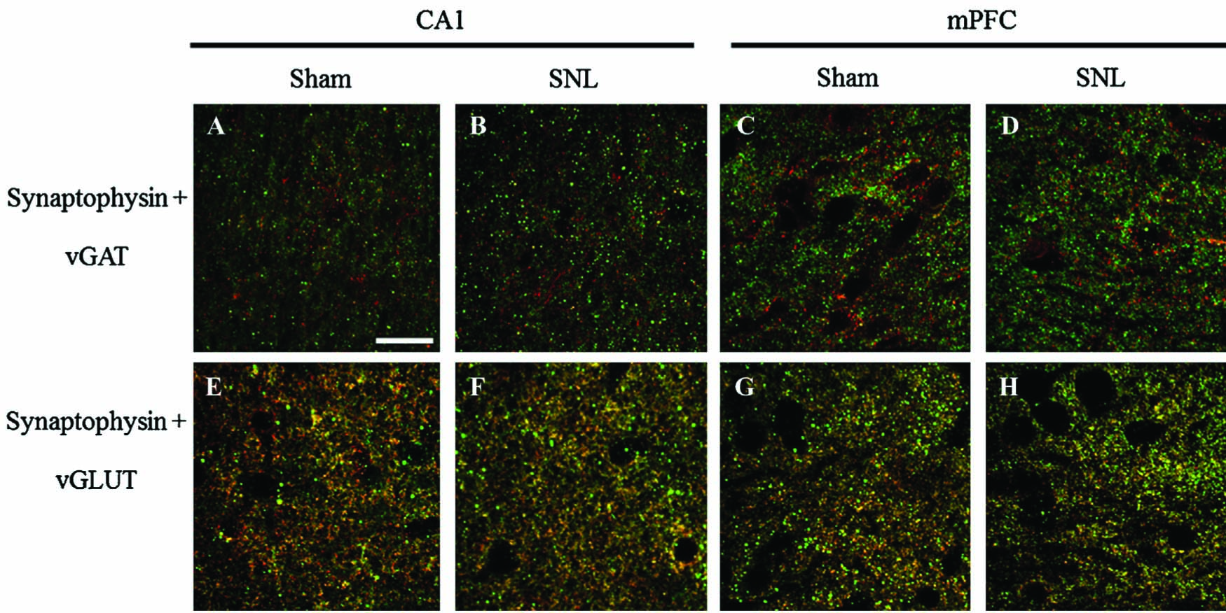 Fig. 11
Representative images of double immunostaining for synaptophysin and vGAT (A-D) and synaptophysin and vGLUT (E-H) in the CA1 region of the hippocampus and the mPFC (prelimbic area). Scale bar–30 μm.