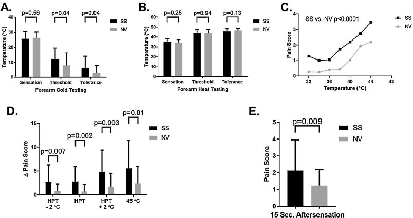 Fig. 1 
              Static thermal pain threshold/tolerance testing and dynamic thermal temporal summation testing. (A) Cold testing was performed at sites of the volar forearm. Means with standard deviations are illustrated. (B) Heat testing was also performed on the forearm. Thermal detection threshold (sensation in the figure), pain threshold and pain tolerance means with standard deviation are illustrated. (C) Pain scores (0-20 scale) after each of 14 random order thermal pulses between 32 and 44 °C. Sickle cell status (p< 0.0001) and temperature (p< 0.0001) were associated with pain scores (ANCOVA). (D) Temporal summation thermal testing at individualized heat pain thresholds shows enhanced A pain scores in sickle cell anemia. Δ pain scores are reported as means with standard deviations. (E) Aftersensations suggested by pain scores 15s after thermal sequence pulses in panel D.
            
