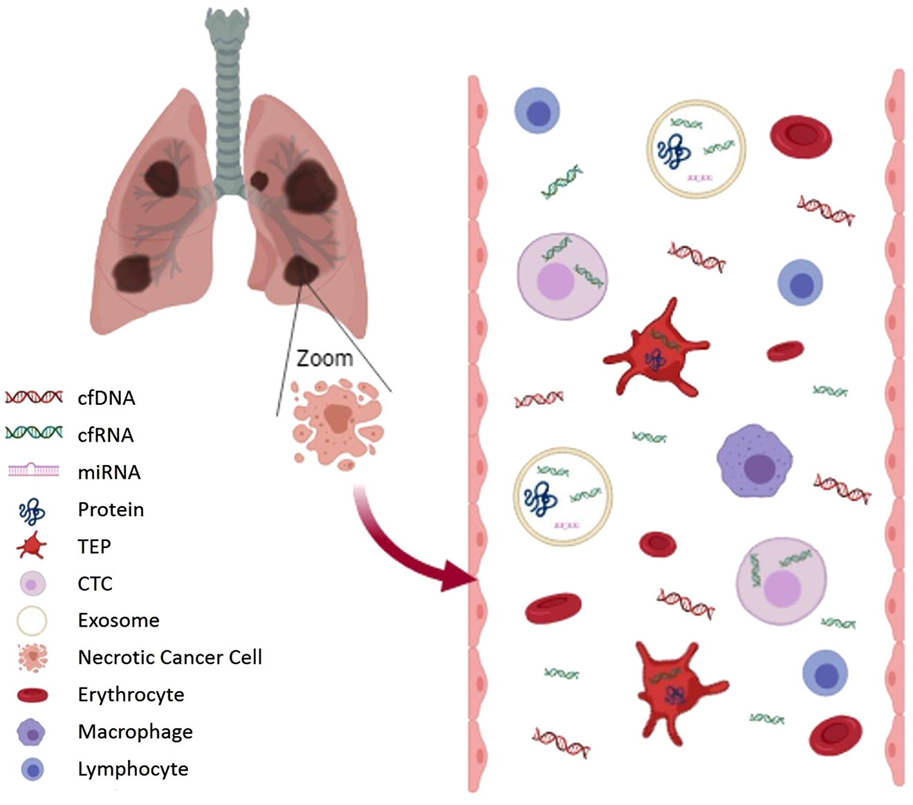 Figure 3:
Components of liquid biopsy sample.
cfDNA and cfRNA in blood come from dying cells (necrosis or apoptosis). A small fraction of cfDNA is ctDNA. Wild type DNA from blood cells can dilute ctDNA and therefore pre-analytical conditions should avoid cell lysis. CTCs, platelets (TEPs) and exosomes can capture these molecules and others, such as miRNA or cancer cell proteins. This genetic information is better protected in these compartments than in the bloodstream. (Figure designed by https://app.biorender.com/).