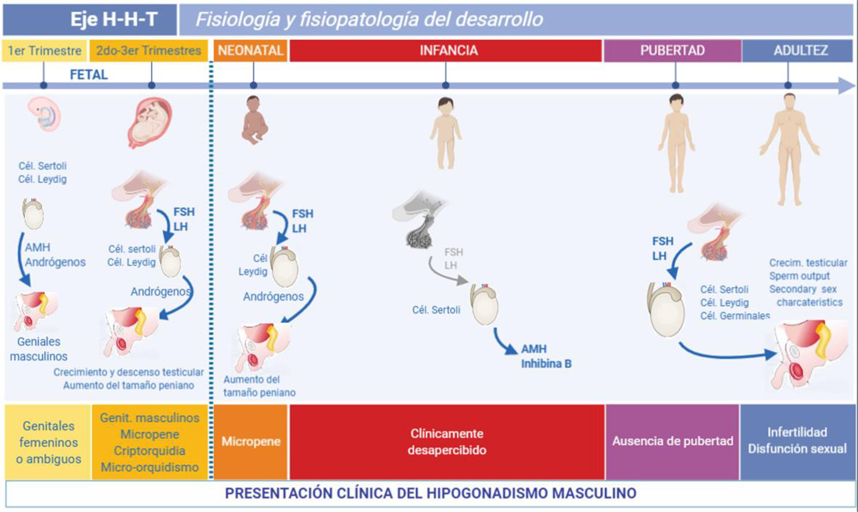 Figura 1: 
Ontogenia del eje hipotalámico-hipófisis-testicular (H-H-T) en el varón y su impacto en la presentación clínica del hipogonadismo.
Las gónadas se diferencian en el primer trimestre de la vida fetal, independientemente de las gonadotrofinas hipofisarias. Los andrógenos testiculares y la hormona anti-Mülleriana (AMH) provocan la diferenciación masculina de los genitales; su ausencia conduce a la diferenciación femenina. El hipogonadismo en este período lleva al desarrollo de genitales ambiguos o femeninos en individuos XY. En los trimestres segundo y tercero, los andrógenos provocan el descenso testicular y el agrandamiento del pene. Los hipogonadismos primarios y secundarios dan como resultado micropene, microorquidismo y/o criptorquidia en un recién nacido que presenta genitales masculinos. En los primeros meses de la vida posnatal, la secreción de gonadotrofinas y andrógenos es activa; el hipogonadismo impide el agrandamiento del pene en los niños. Durante la infancia, las gonadotrofinas y la testosterona son normalmente bajas o incluso indetectables; el hipogonadismo establecido en este período no da lugar a signos clínicamente evidentes y sólo puede detectarse si se evalúan los niveles de AMH o inhibina B. Durante la pubertad, el eje H-H-T se reactiva y provoca el desarrollo típico de caracteres sexuales secundarios; el hipogonadismo puede provocar un desarrollo puberal ausente o incompleto, o más tarde infertilidad y disfunción sexual. Esta figura se modificó utilizando BioRender (https://biorender.com/) con permiso de Grinspon RP, Freire AV, Rey RA. Hypogonadism in Pediatric Health: Adult Medicine Concepts Fail. Trends Endocrinol Metab 2019;30(12):879–890. © 2019 Elsevier Ltd.
