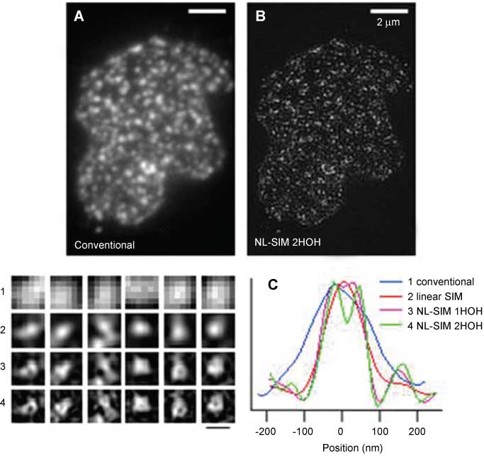 Figure 3 Nonlinear structured illumination of the nuclear pore.The nuclear pore protein POM121 was fused to Dronpa, a photo-switchable fluorescent protein, and imaged by either conventional wide-field microscopy (A) or nonlinear structured-illumination microscopy (NL-SIM) (B). The localization pattern of POM121, an integral membrane protein, was markedly different when imaged by NL-SIM with one or two higher order harmonics (HOH) (3, 4) than when imaged by conventional (1) or even linear structured-illumination microscopy (2). This is confirmed by taking a line profile through a nuclear pore (C). Scale bar, 200 nm (1–4). Image kindly provided by Hesper Rego, Department of Immunology and Infectious Diseases, Harvard School of Public Health, Boston, MA 02115, USA.