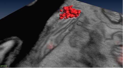 Figure 5 Correlative 3D microscopy.The red isosurface is from mEOS2 labeling TFAM, which associates with the mitochondrial DNA (nucleoid) and was detected with iPALM. The ultrastructural context of the mitochondria is provided by focused ion beam scanning electron microcopy (FIB-SEM). Shown is one slice gray-colored. Membrane cristae are visible as grooves in the vicinity of the nucleoid. As a perspective view of the surface is shown, no scale bar is given. However, the mitochondrial nucleoid is approximately 400 nm across. Courtesy of Janelia Farms Research Campus, Howard Hughes Medical Institute, Ashburn VA, USA.