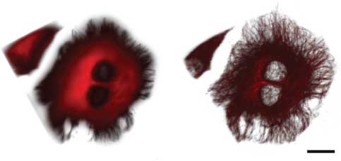 Figure 7 3D SOFI image of microtubular network.Microtubules in HeLa cells were stained via secondary antibodies coupled to QD800 (InVitroGen). Left image is the wide-field image, right image the SOFI representation. Scale bar, 20 μm. An image  z-stack consisting of 32 frames and a step size of 200 nm was taken in a wide-field microscope with LED illumination. Each plane represents 2000 frames. Image reprinted from [84] under license policy of the journal ‘Optical Nanoscopy’ and with permission of the authors.