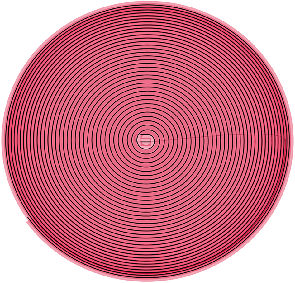 Figure 9:
Laser focus scan pattern used for cornea “flap” cutting during refractive LASIK surgery. Copyright© Ziemer Ophthalmic Systems.