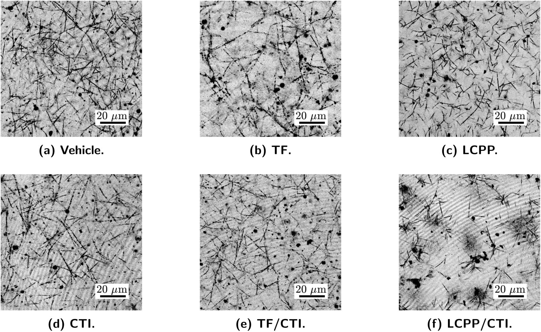Figure 6 
                  Confocal microscopy images of fibrin networks after 24 h of coagulation. The particles that are presented in the images include the probing particles as well as other substances that naturally exist in plasma. (a) A fibrin clot that was formed with vehicle control. (b) A fibrin clot that was formed with the initiation of TF, resulting in a denser network with longer fibers, compared with other samples. (c) A fibrin network that was initiated by LCPP, which also shows a dense structure. (d) A fibrin clot that was formed with the inhibition by CTI. The image shows thinner polymer fibers when compared with the vehicle-controlled sample in (a). (e) A fibrin clot that was initiated by TF with the inhibition by CTI. This clot developed thinner fibers, even though CTI and TF directly function in different pathways. (f) A fibrin clot that was initiated by LCPP and inhibited by CTI. The clotting was inhibited by CTI, resulting in a poorly developed gel with a heterogeneous structure and large voids.
               