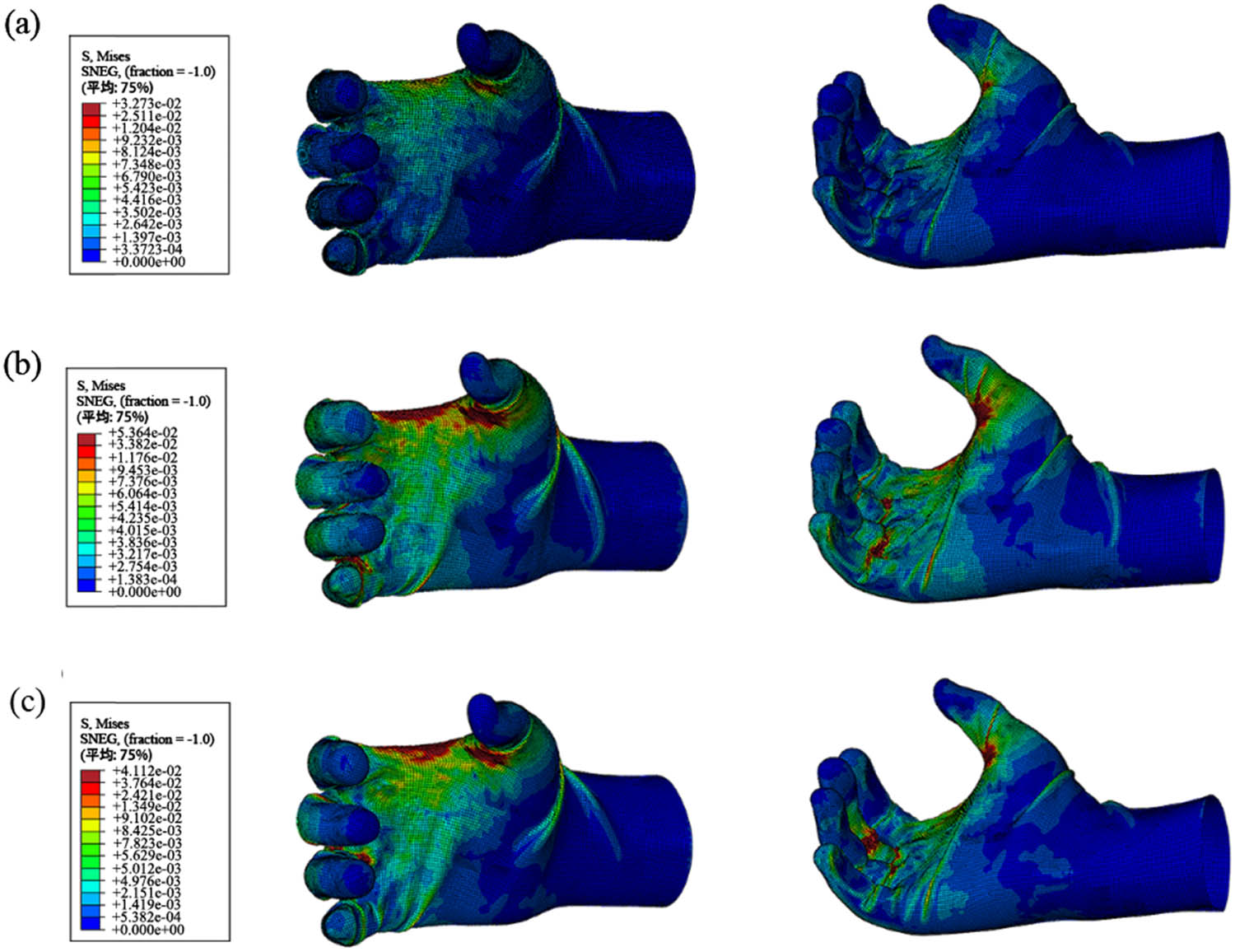 Figure 12
The stress distribution of gloves: (a) fabrics 1, (b) fabric 2, and (c) fabric 3.