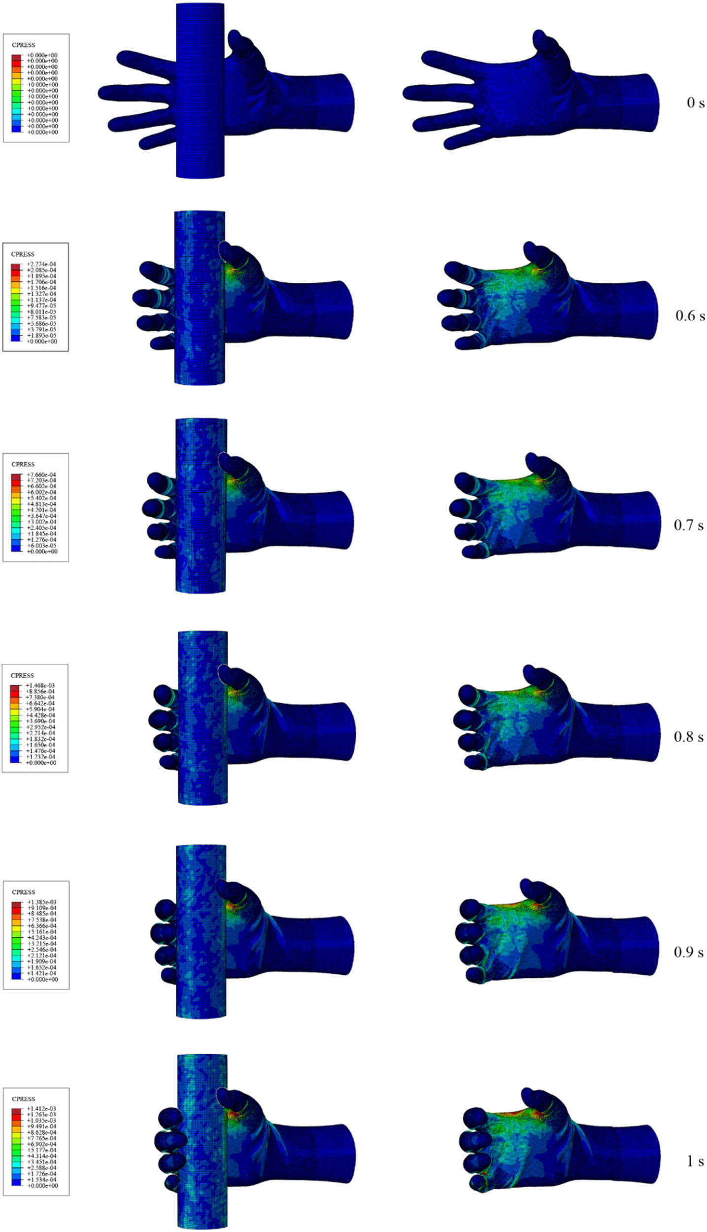 Figure 14
The cloud diagram of the contact pressure of the finger flexing dynamic grip process in the state of wearing the fabric 1 glove.