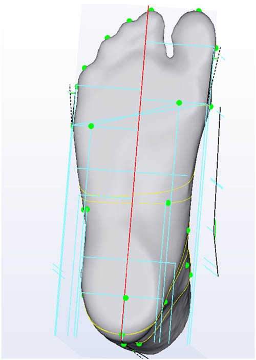 Figure 2
Foot length.