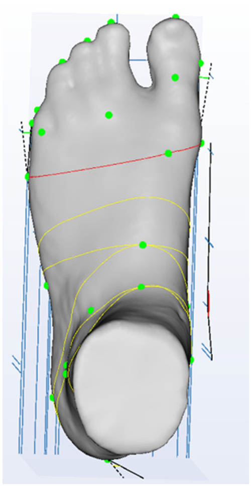 Figure 4
Ball girth.