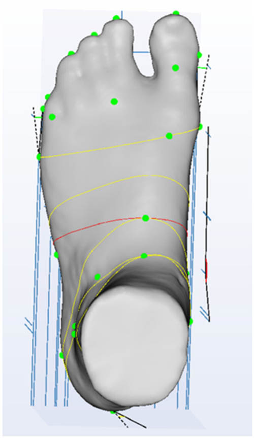 Figure 5
Instep girth.