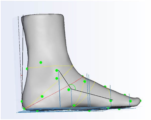 Figure 6
Long heel girth.