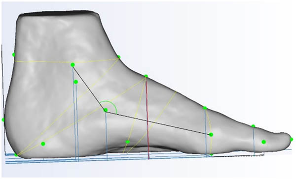 Figure 8
Instep height.