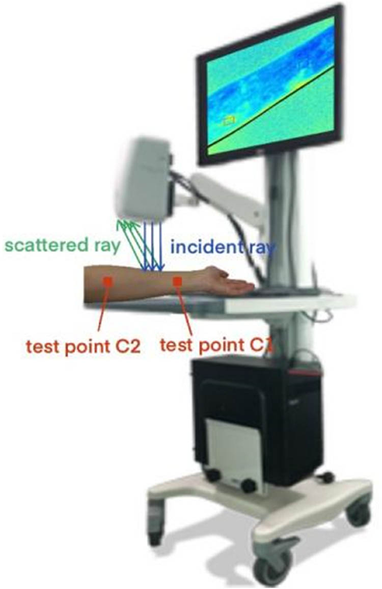 Figure 1 
                     BVI microcirculation blood flow imager and experimental principle.
                  