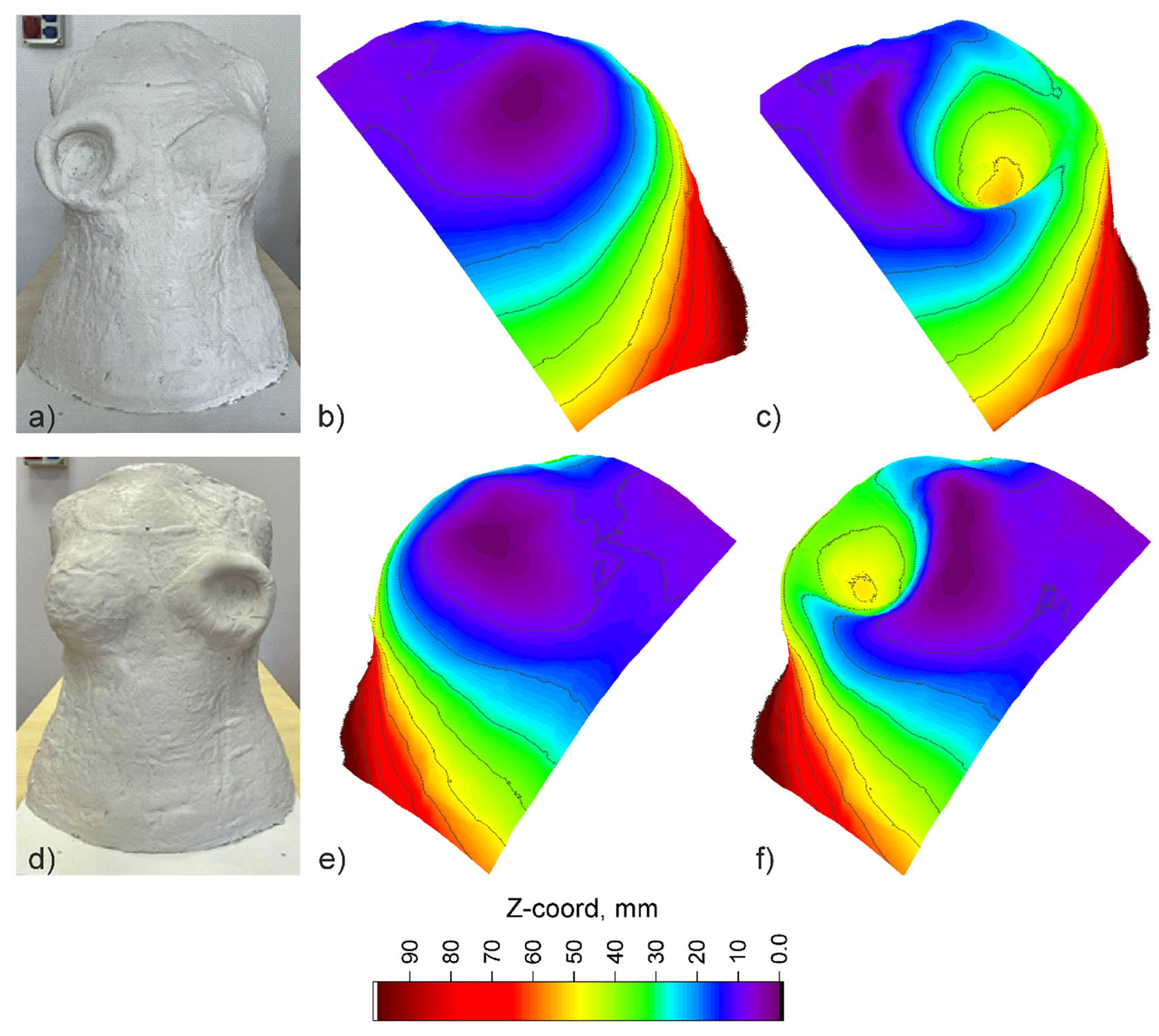 Figure 10
Breast deformation during bullet impact – experimental studies: (a) view of plasticine model after bullet impact – protective package of 16 layers, (b) right breast before bullet impact, (c) right breast after bullet impact protected by package of 16 layers, (d) view of plasticine model after bullet impact – protective package of 30 layers, (e) left breast before bullet impact, and (f) left breast after bullet impact protected by package of 30 layers.