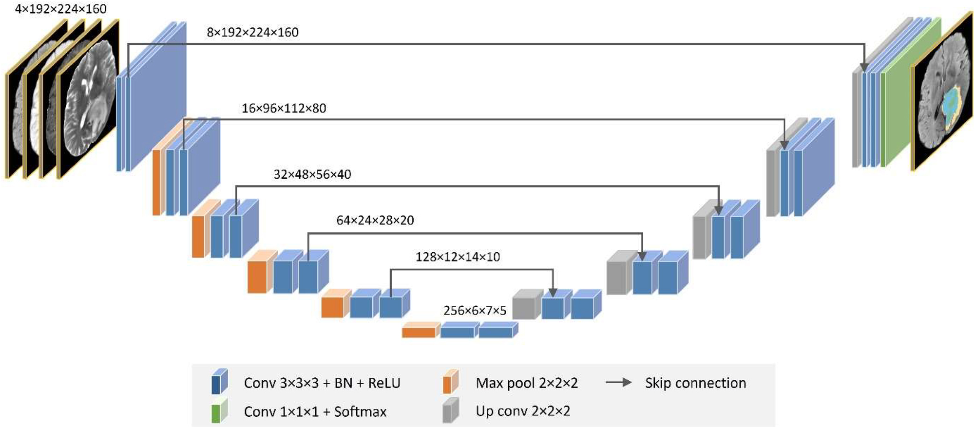 Figure 4: 
The architecture of the enhanced 3D brain segmentation network (3D DeepSeg) for brain tumor segmentation from mpMRI volumes. The input is a 3D multimodal MRI of T1, T1Gd, T2, and FLAIR with a patch spatial resolution of 192 × 224 × 160. The CNN network has 24 convolution neural blocks (blue boxes), four downsampling blocks (orange boxes), four upsampling blocks (grey boxes), and a final softmax output layer (green box).
