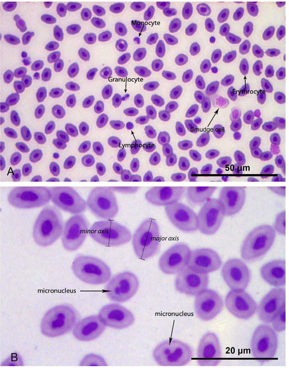 Figure 1 (A) Blood smear from the control sea bass cage with different cell types. (B) Blood smear from aerated sea bass cage with the presence of micronucleus.
