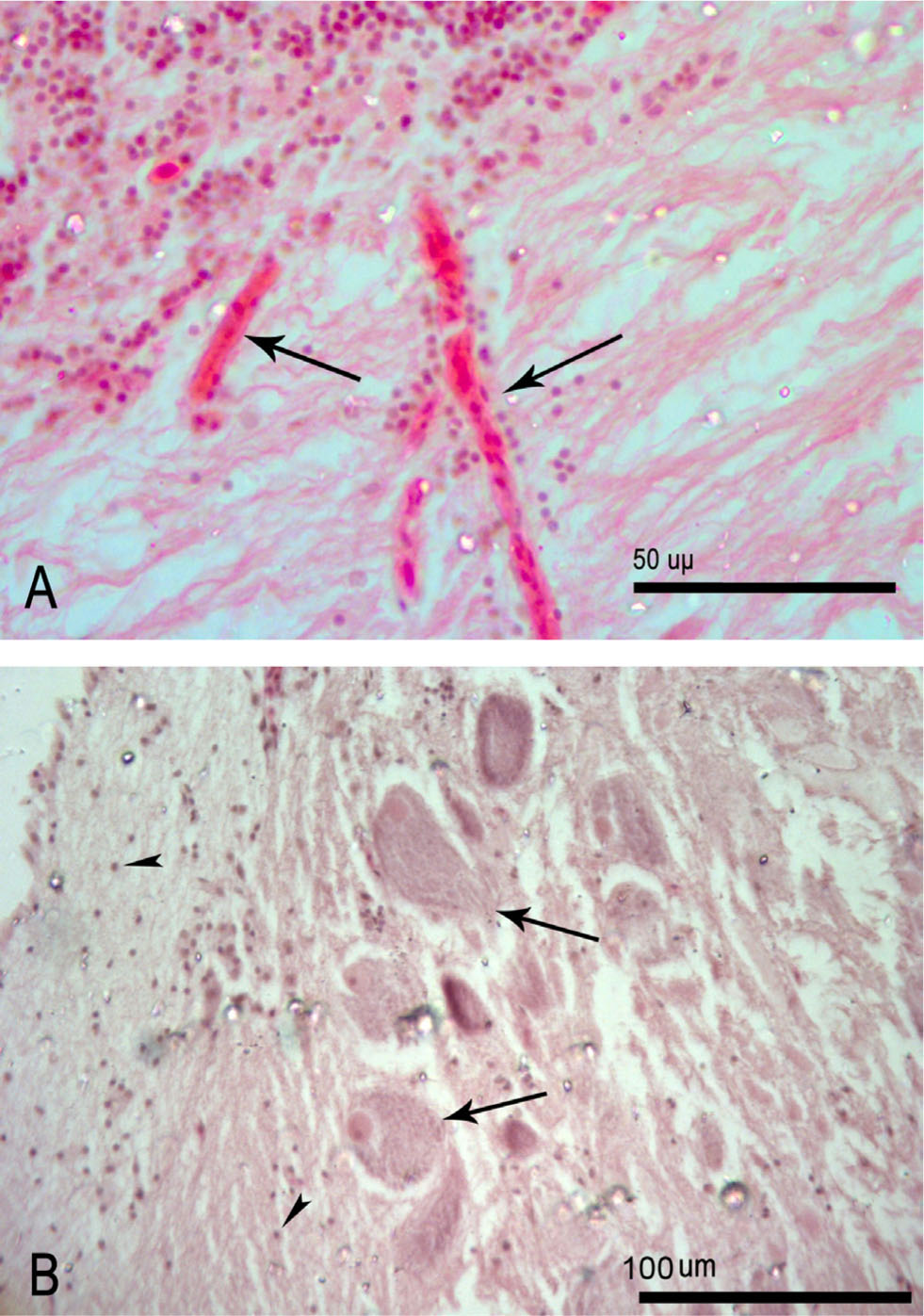 Figure 3 (A) Cerebellum section. Normal histological architecture with no haemorrhagic signs, as the capillaries (arrows) appeared intact. (B) Gray matter section. Neurons (arrows) and neuroglial cells (arrow head) appeared normal.