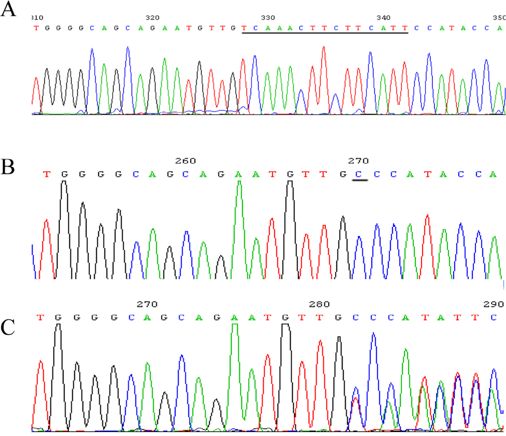 Figure 5 SNP at site g. 12951–12965 located in intron 3.(A) The GenBank sequence (ACCESSION: NG_007081 VERSION: NG_007081.1) with g. 12951-12965 TCAAACTTCTTCATT in seven samples. (B) Replacement of TCAAACTTCTTCATT with C in one sample. (C) No clearly separated peak downstream of T was observed in five samples. DNA samples were extracted from white blood cell samples. The target region in the IRF6 gene was amplified using PCR. The PCR product was sequenced by Shanghai Megiddo Biological Pharmaceutical Co., Ltd.