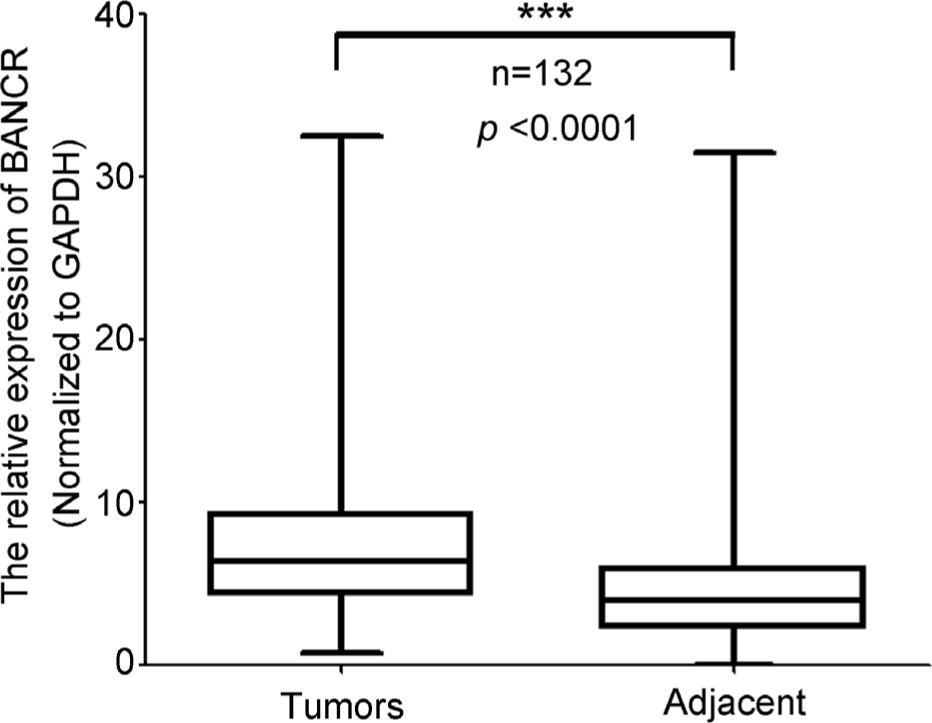 Figure 1 BANCR expression is positively correlated with the progression of ESCC. The total RNA of fresh ESCC and adjacent normal tissues were extracted using Spin Column Animal total RNA purification Kit and performed according to the Manufacturer’s Manual, and the total RNA was then reverse-transcribed into cDNA. The mRNA levels of BANCR were detected by quantitative real-time PCR (*p<0.05, **p<0.01, ***p<0.001, Pearson’s correlation, n=132).