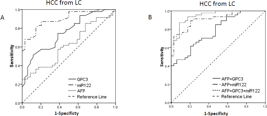 Fig.4 ROC curve for AFP, GPC3 and miR-122, and their combinations for discriminate early-stage HCC from LC. AUC for GPC3, miR-122 and AFP were 0.752, 0.900 and 0.618 respectively. AUC for combinations of AFP+GPC3, AFP+miR-122 and AFP+GPC3+miR-122 were 0.782, 0.911 and 0.949 respectively. Combination of the three biomarkers could improve AUC than AFP alone (P<0.05). (ROC, receiver operating characteristic, AUC area under ROC curve, LC liver cirrhosis, HCC hepatocellular carcinoma)