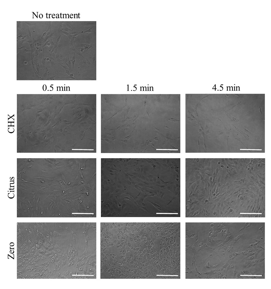 Figure 2 Evaluation of cellular morphology after treatment with 0.12% CHX, LIS Citrus, and LIS Zero. The scale bar indicates 200 μm.