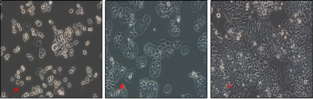 Figure 1 Growth of HT29 cells at different time points under the light microscopy at 400x magnification A: 24h, B:48h, C:72h