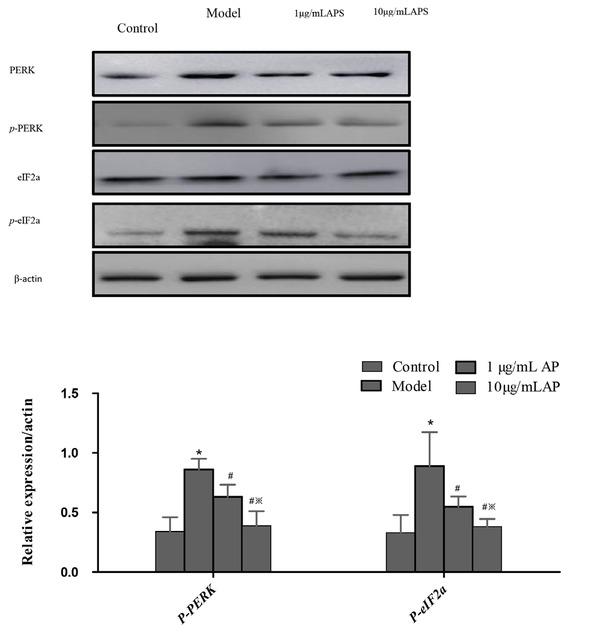 Figure 4 Western blot of proteins involved in the UPR pathway following APS treatment in HT29 cells.