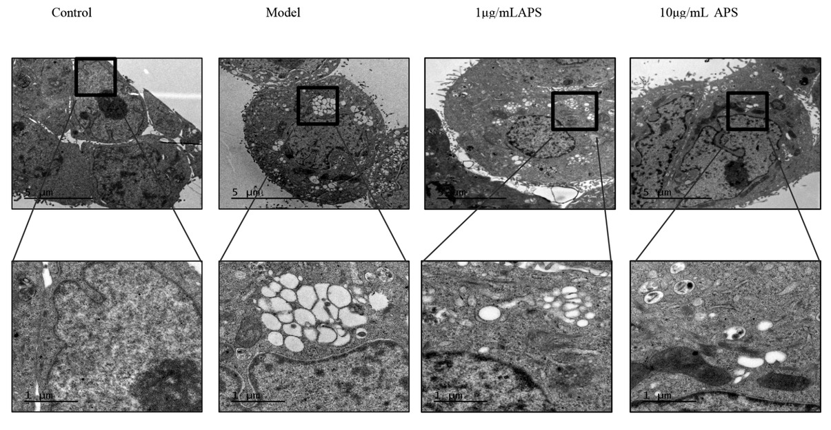 Figure 6 Astragalus polysaccharides treatment disrupts the ER ultrastructure of HT29 cells