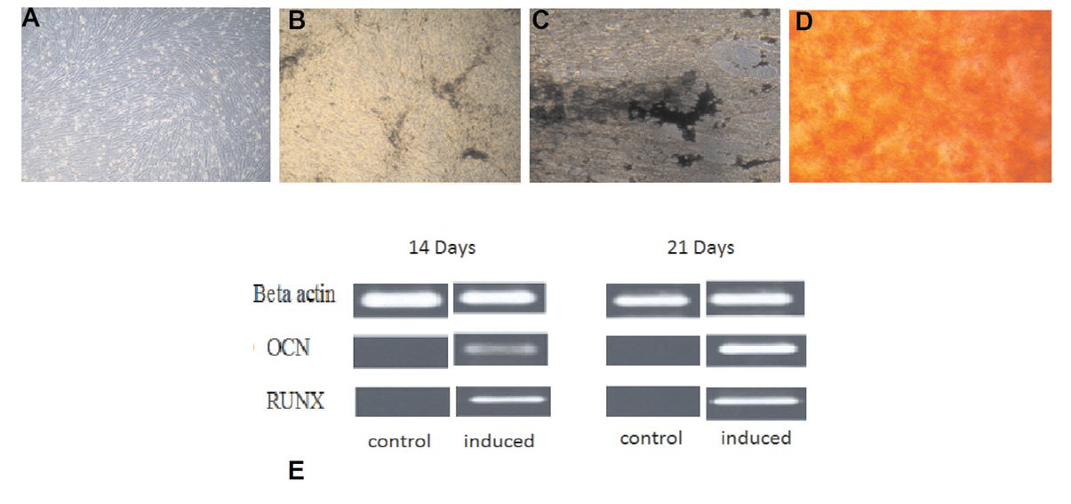 Figure 4 Differentiation potential of DPSCs. A) controlled, B, C) Von kossa staining at day 14 and 21 respectivly, confirming mineral deposition by newly formed osteoblasts D) alizarin red staining at day 21 E) showing positive results of RUNX2 and OCN at day 14 and 21 of osteogenic differentiation through polymerase chain reaction.