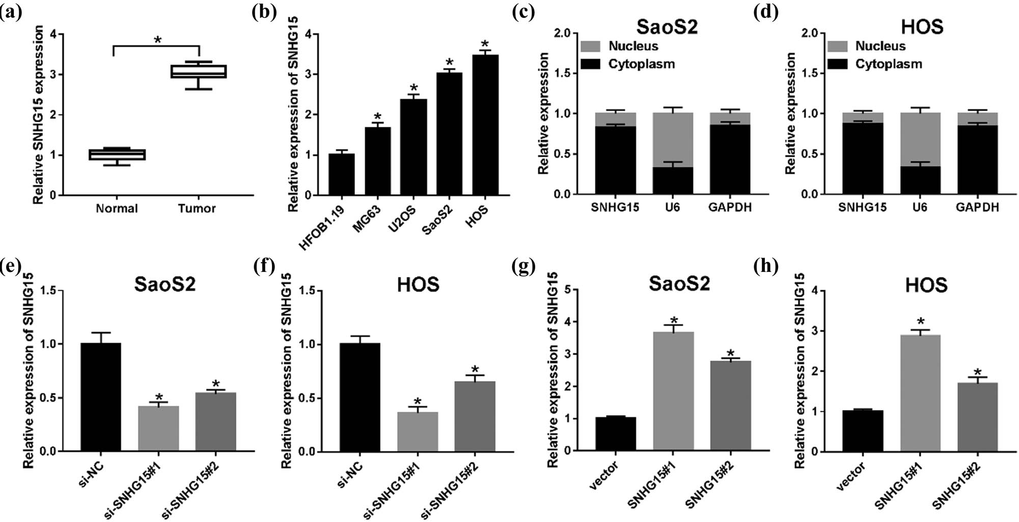 Figure 1 The roles of lncRNA SNHG15 in OS tissues and cells. (a) qRT-PCR was used to detect the expression of lncRNA SNHG15 in tissues from 30 patients with OS compared with the adjacent parts. (b) The expression of SNHG15 in human osteoblast cells (HFOB1.19) and OS cells (MG63, U2OS, SaoS2, and HOS) was measured by the qRT-PCR assay. (c and d) Localization of SNHG15 in SaoS2 and HOS cells was analyzed by the Subcellular fractionation assay. (e and f) The relative expression level of SNHG15 was detected in SaoS2 and HOS cells transfected with si-NC, si-SNHG15#1, and si-SNHG15#2. (g and h) The SNHG15 level was measured in SaoS2 and HOS cells transfected with vector, SNHG15#1, and SNHG15#2. *P < 0.05.