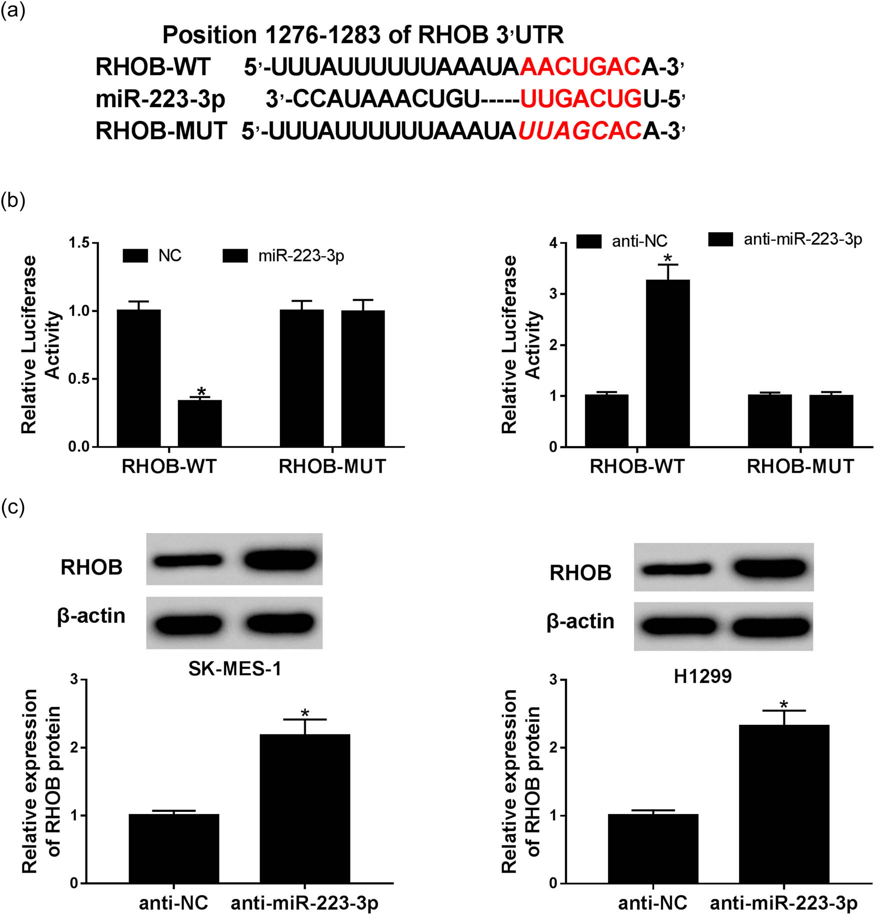 Figure 3 
                  The target relationship between miR-223-3p and RHOB was predicted and verified. (a) The binding site between miR-223-3p and RHOB predicted by starBase Web site was exhibited. (b) The luciferase activities of RHOB-WT and RHOB-MUT transfected with miR-223-3p, NC or anti-miR-223-3p, anti-NC were measured by dual-luciferase assay (n = 3). (c) The level of RHOB protein in SK-MES-1 and H1299 cells transfected with anti-NC or anti-miR-223-3p was determined by western blot assay (n = 3). *P < 0.05.
               